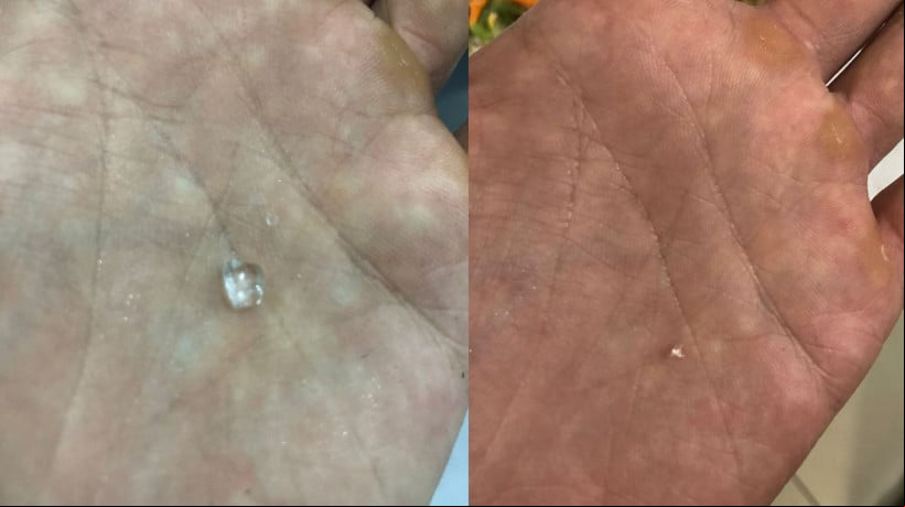 Estudante universitÃ¡rio denuncia presenÃ§a de caco de vidro em sua refeiÃ§Ã£o na Uece 